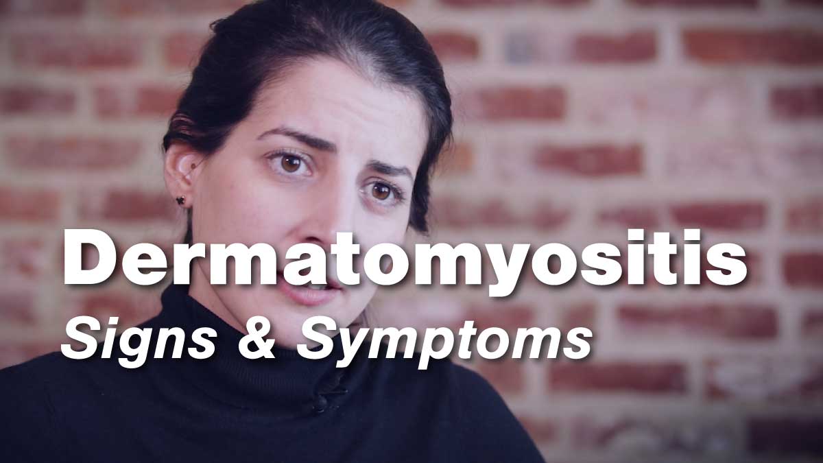 Signs and Symptoms of Dermatomyositis