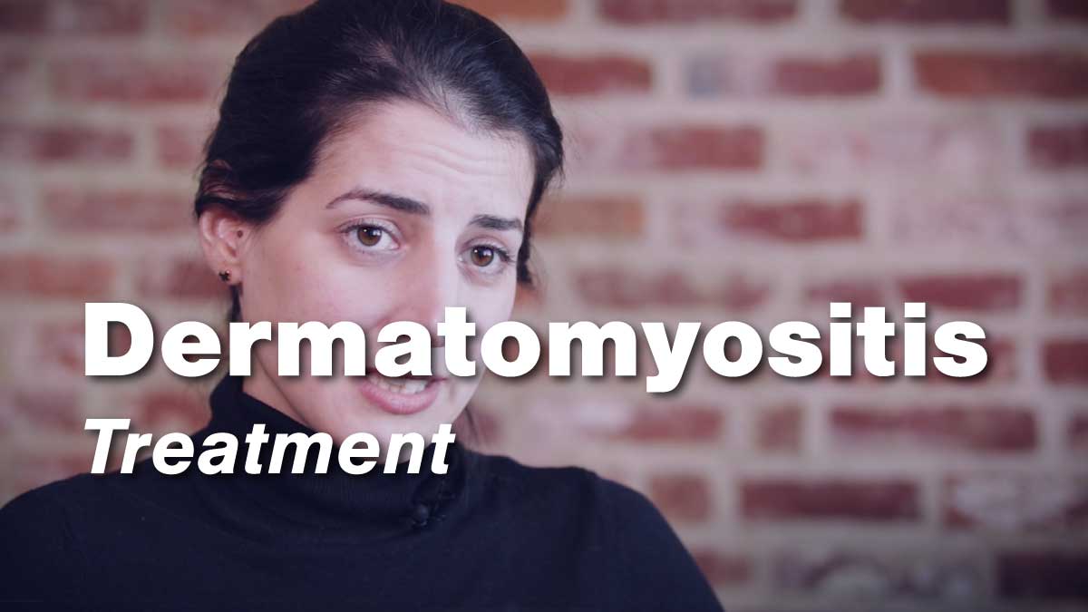 Dermatomyositis Treatment