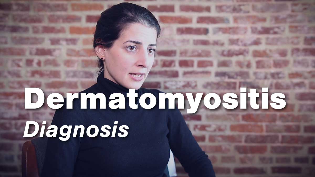 Diagnosis of Dermatomyositis