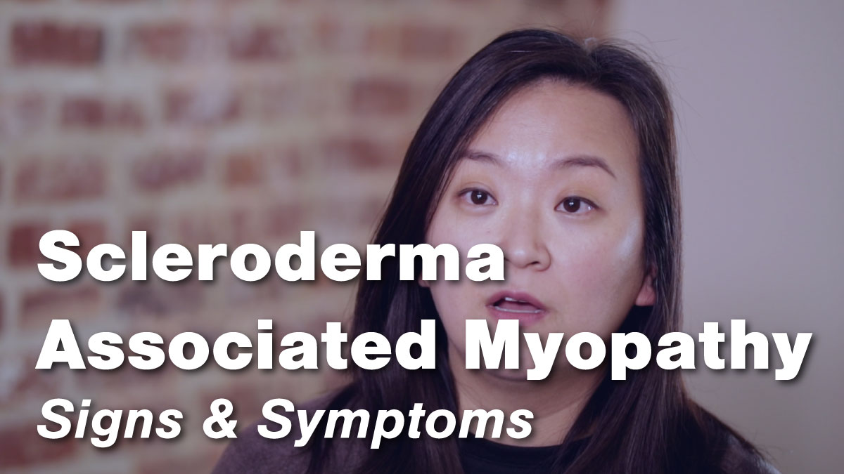 Signs & Symptoms of Scleroderma Associated Myopathy